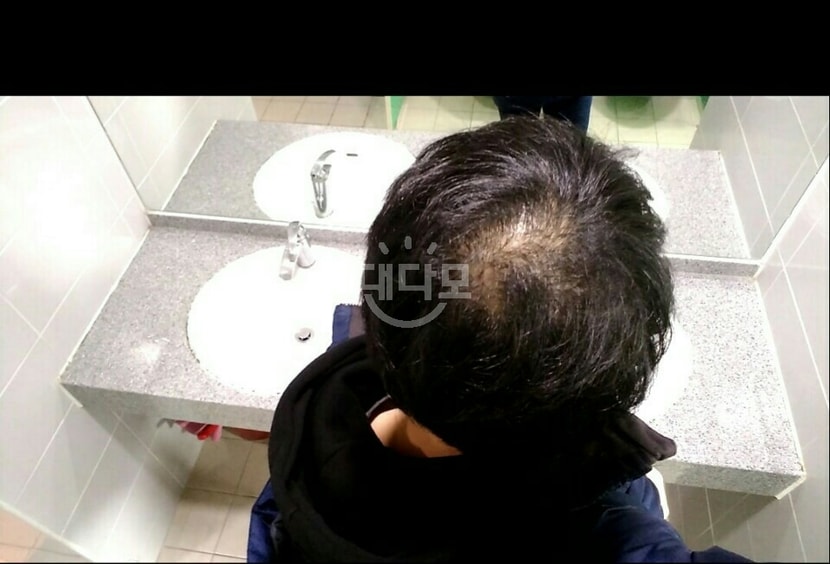 복용 초기