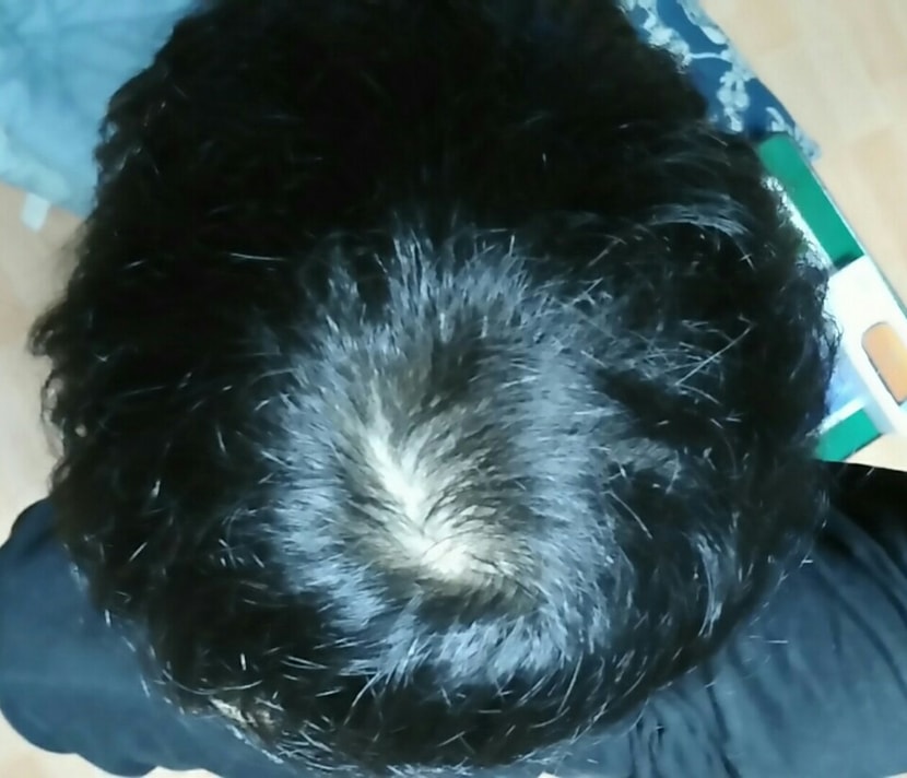 복용 5개월