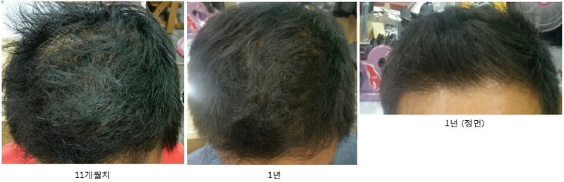 대다모 1년.jpg