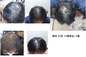 쉐딩왔을때 사진 21년 11월~1월