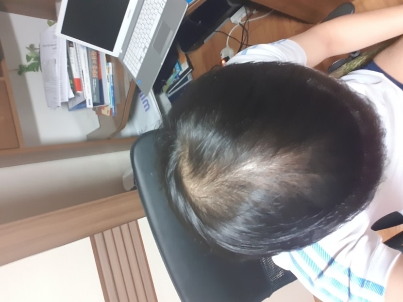 이것도1개월차인데 양쪽으로 가르마 갈랐을때