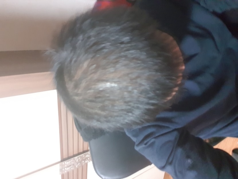 이건 머리짜르고 4개월반정도