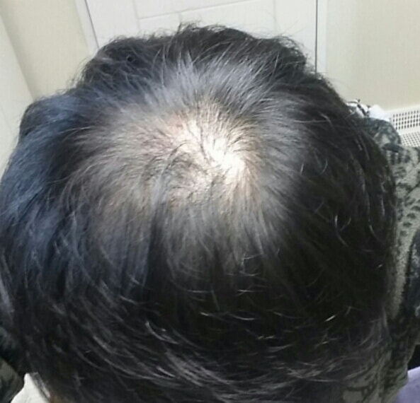 2달차 후기입니다. 조금씩 변화가 보이긴 합니다.