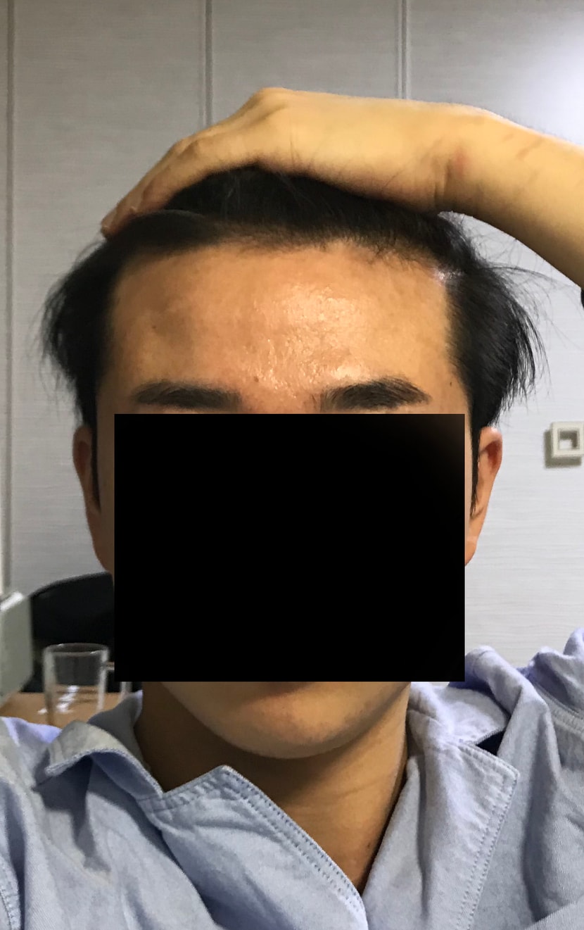 2년 전 사진입니다