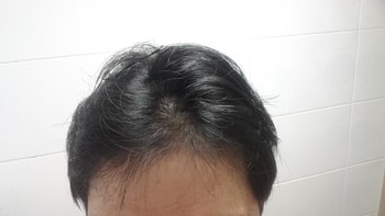 2016.7월 앞