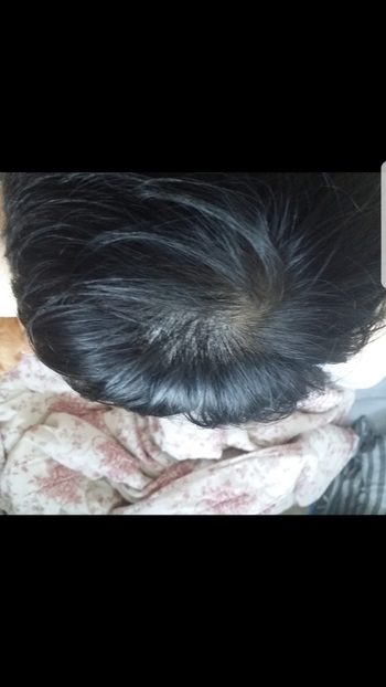 4달 경과 (쉐딩 으로 탈탈털리는게 멈췄습니다)