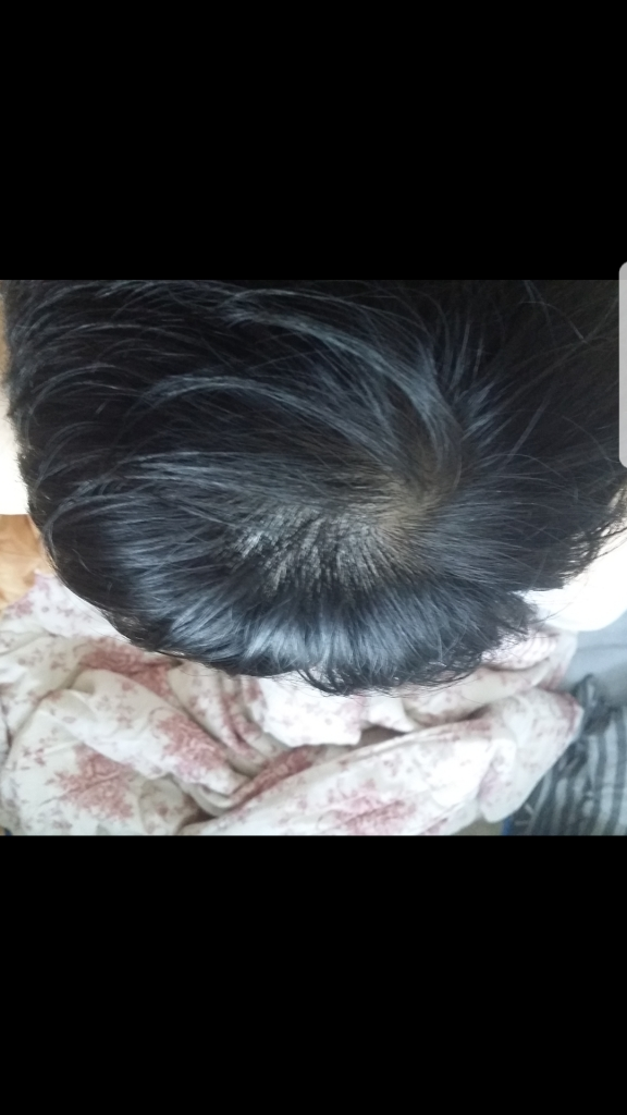 4달 경과 (쉐딩 으로 탈탈털리는게 멈췄습니다)