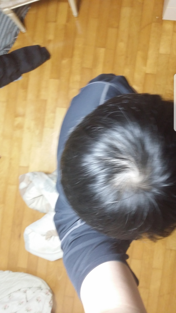 복용전