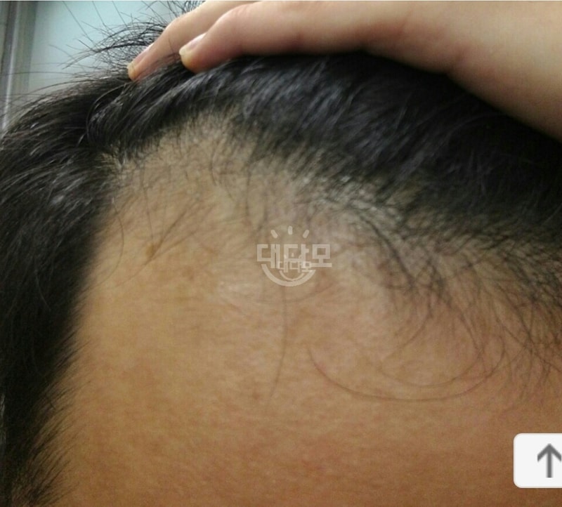 杜塔（达摩达特）1年，米诺克2个月后期