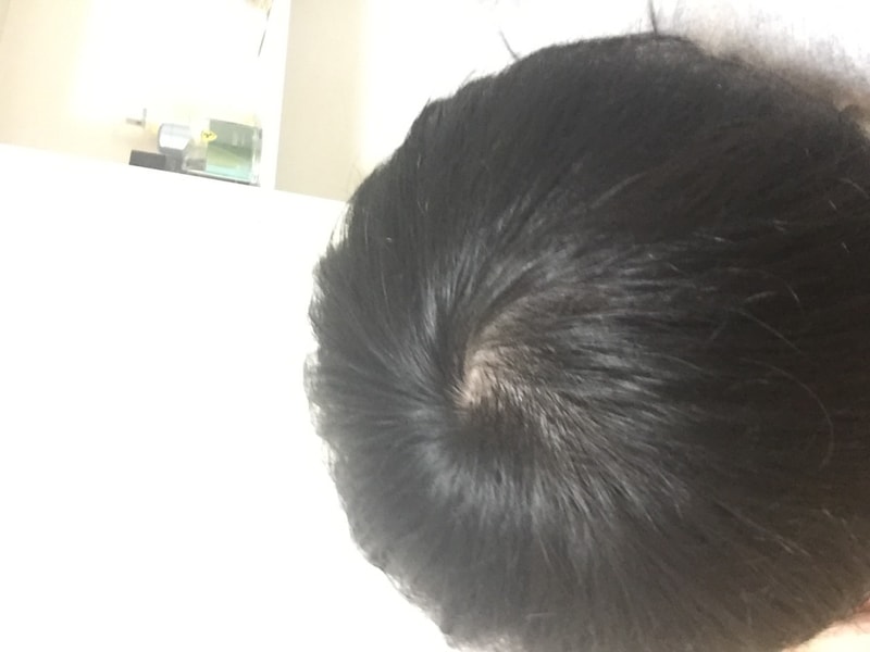 프로스카 1년 8개월, 미녹 6개월