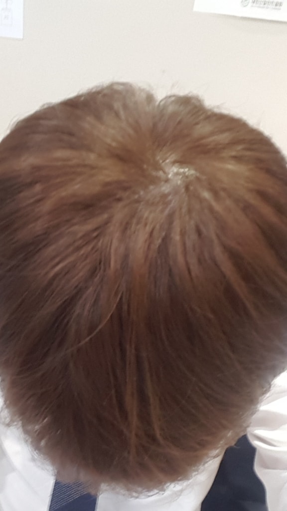 복용 후 사진 입니다