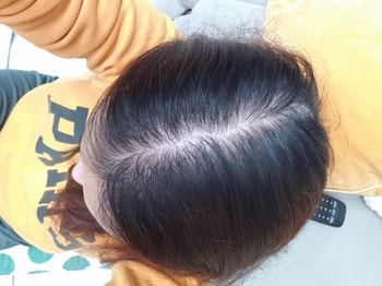 사용 22일차
