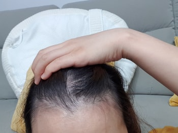 앞쪽 잔머리