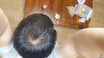 15년 06월 복용 시작
