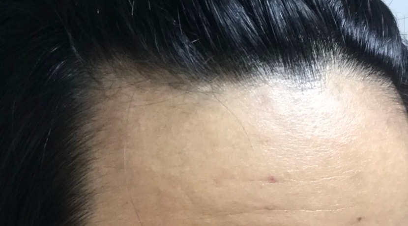 오른쪽