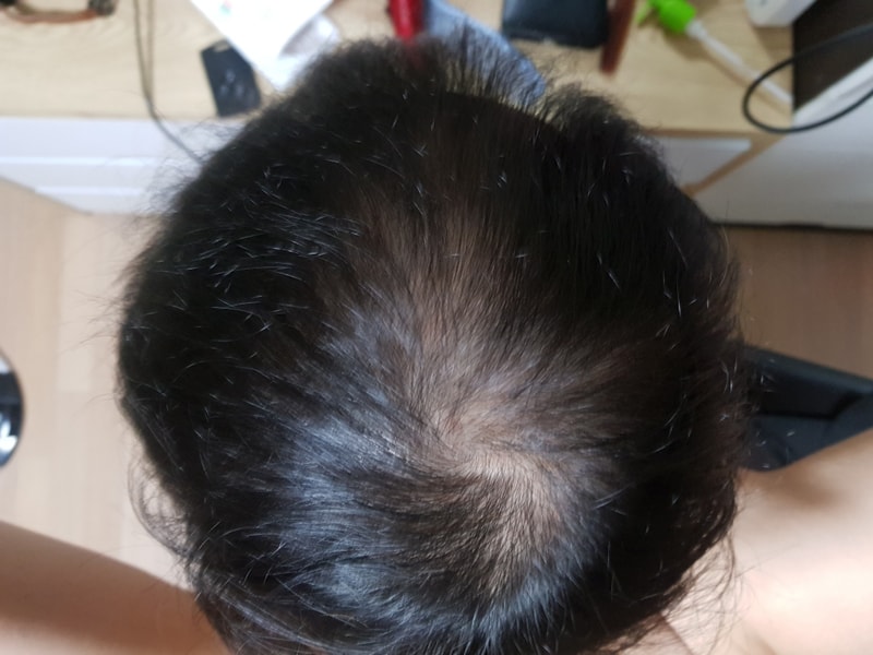 The combination medicine...