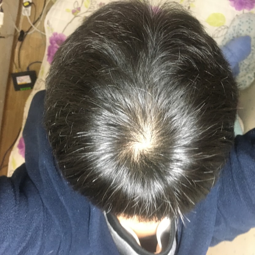 120일후