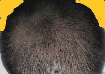 복용후
