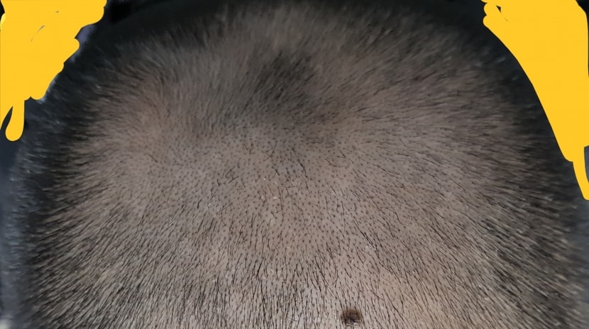 복용전