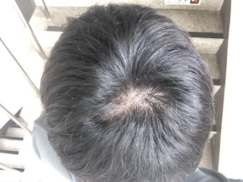 9월