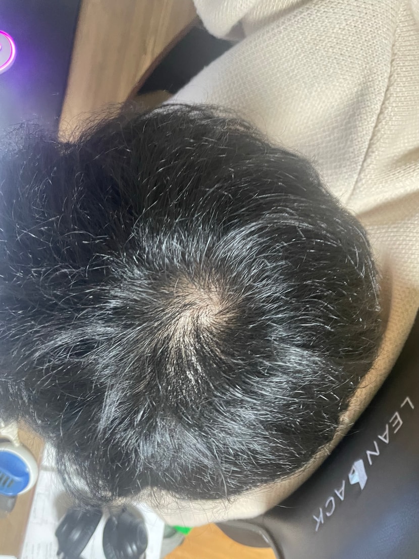 최근