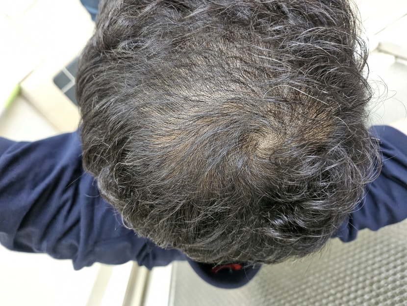 복용6개월