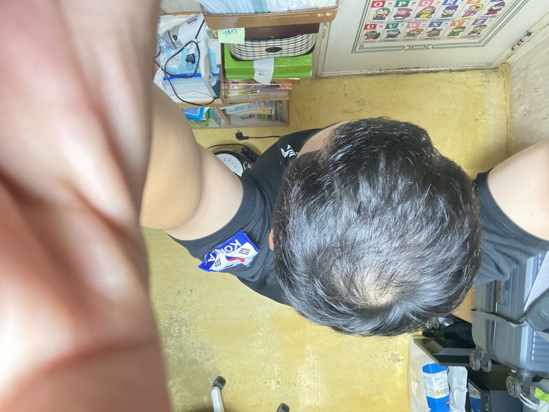 로게인폼 1년후기