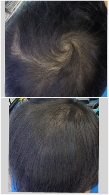 3개월차 쉐딩 끝나고 제가봐도 좀 난거 같더라고요 