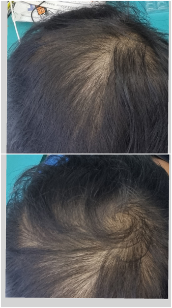 2개월차 쉐딩 진짜 심하게 오더라고요...