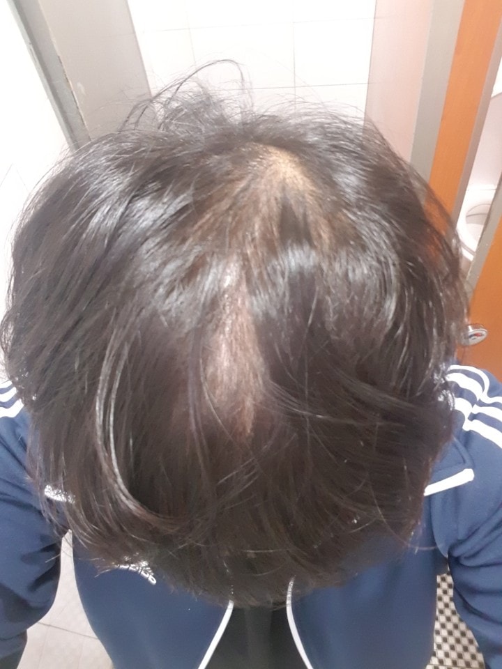 전