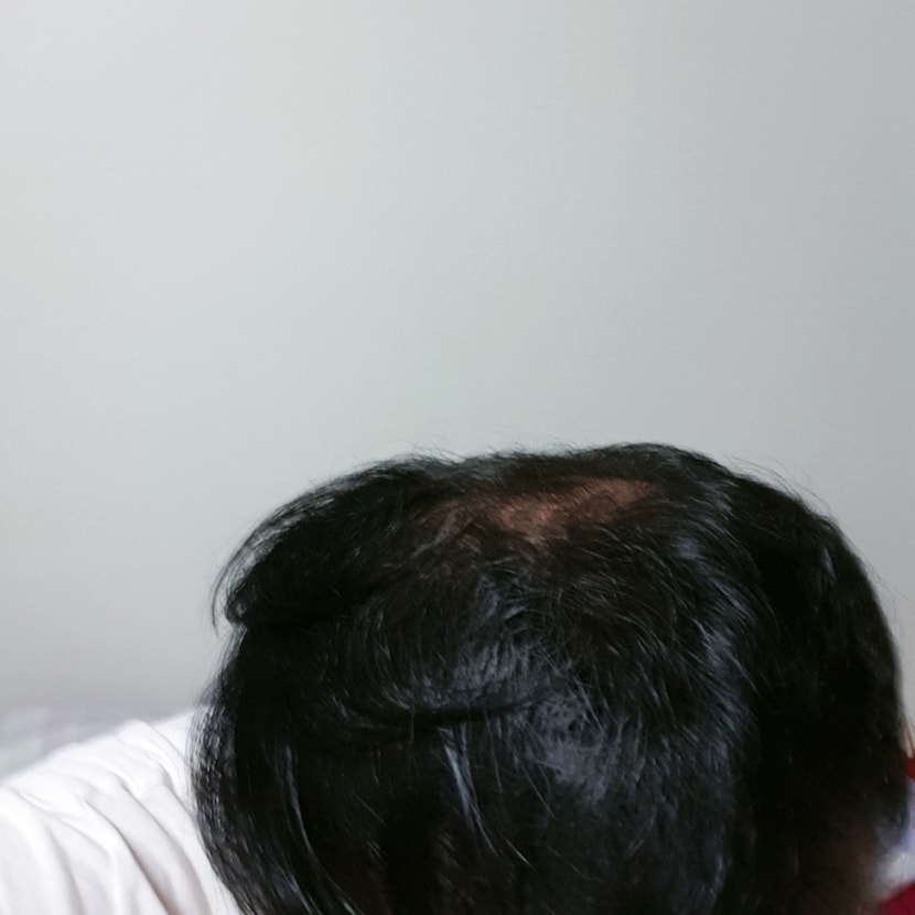 복용 4개월차