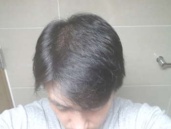 2015년 9월(8개월)