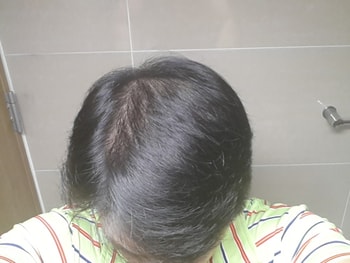 2016년 3월(14개월)