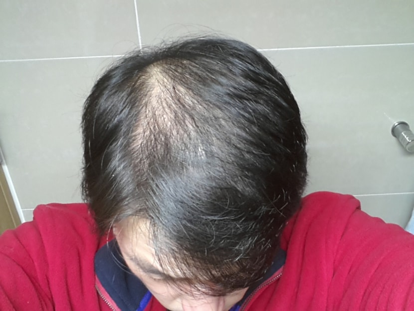 2015년 1월(시작)