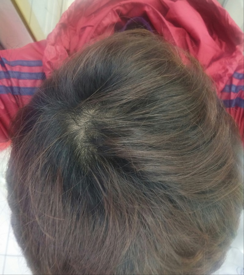 프카 6개월차입니다~