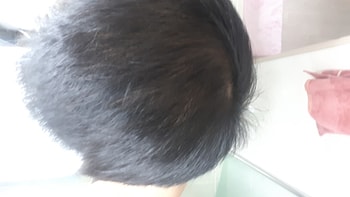 현재 미녹 4달 프페 2달