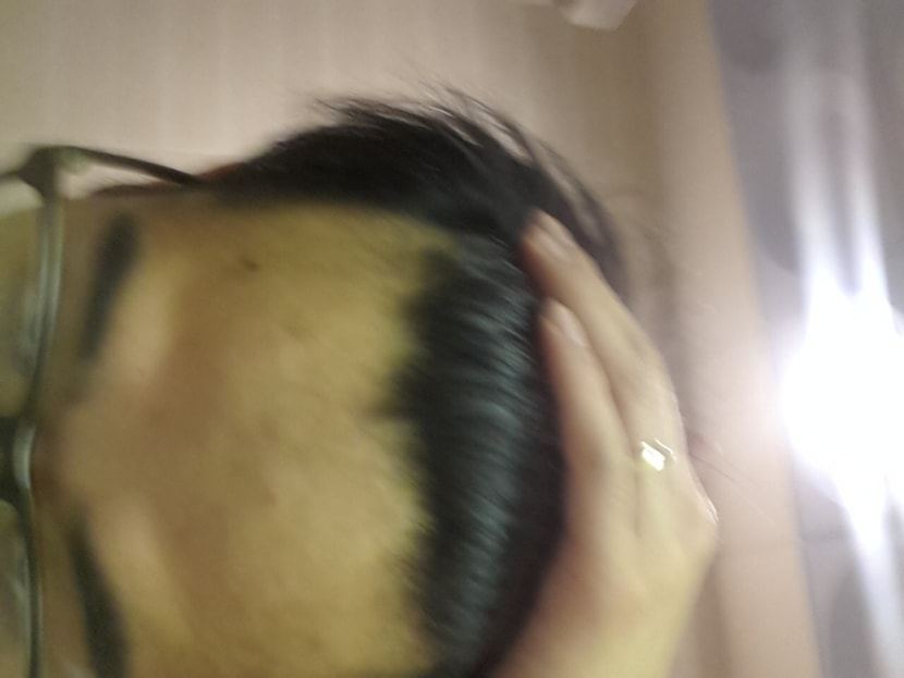1년6개월 m자는 더 진행되는것 같습니다. 슬픕니다.ㅜㅜ