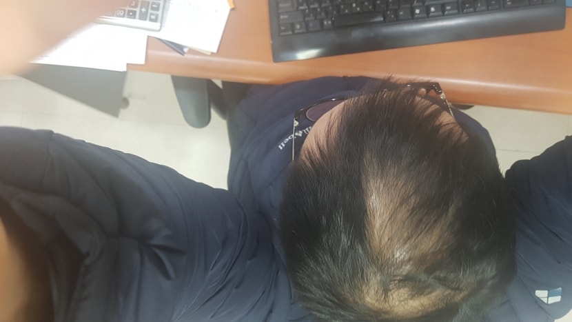 복용전사진