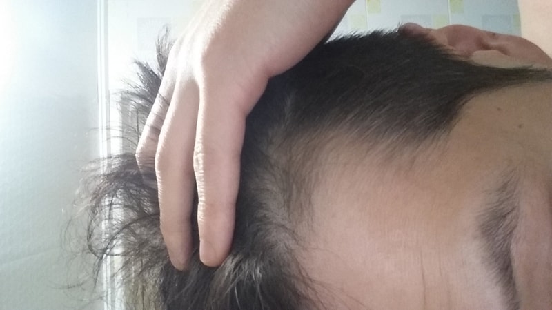 雅培1周后就是1周年了