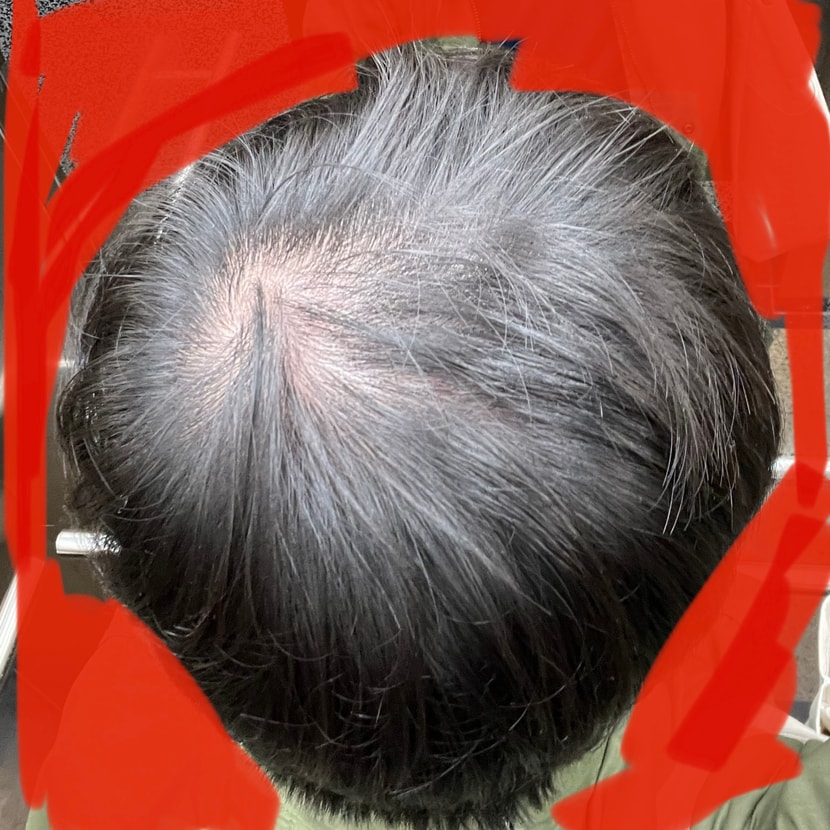 이건 28일째인데 2번째 사진 처럼 같은 엘리베이터 조명아래에요 