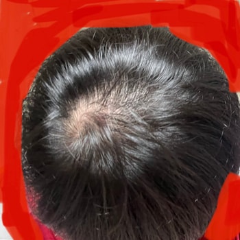 31일차(일반적 조명아래)