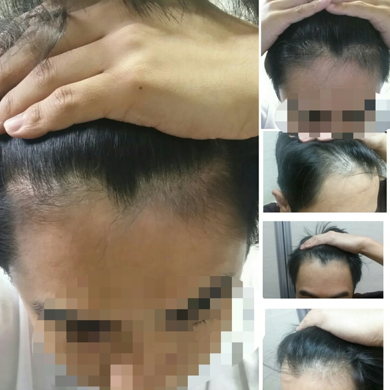 是约4个月的Doota Strate后记 +Kirkle Minok M字头