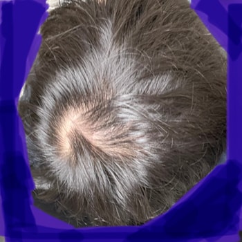 60일째