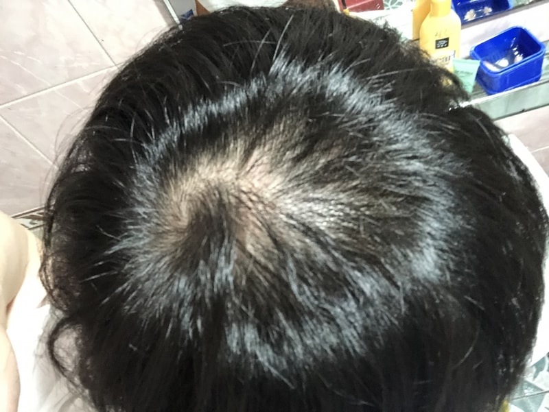 Propecia copy approximately 60 days (2 months)