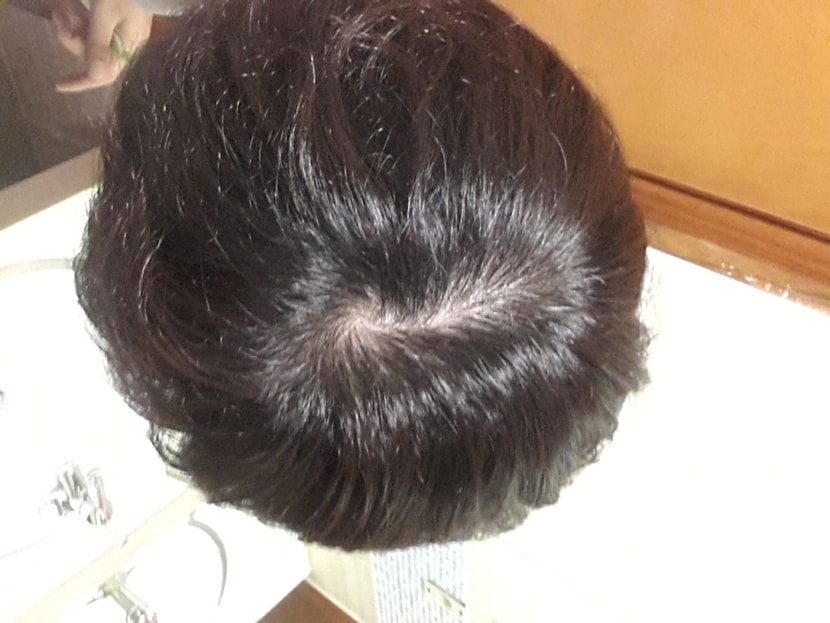 밝은곳에서 다시한번 찍어보았습니다. 2년차 사진입니다.