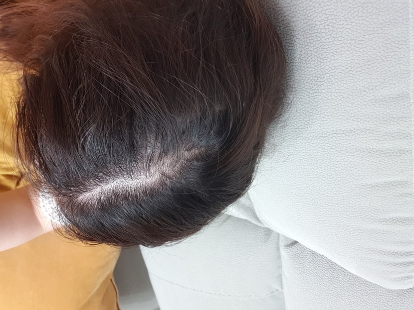 처음시작시