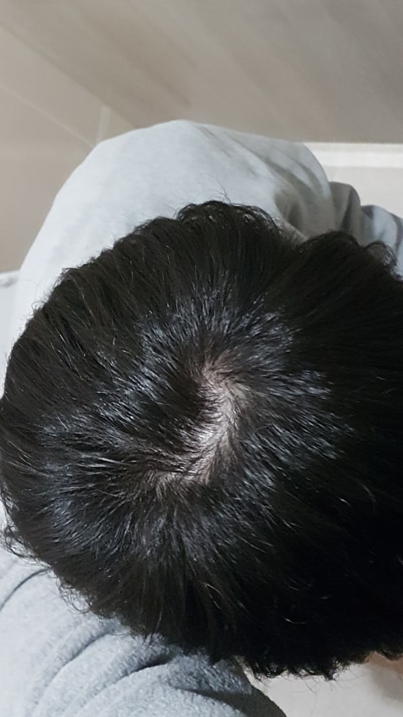오늘 피나 6개월차 사진입니다
