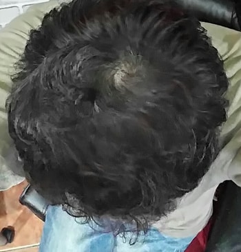 윗머리돌려서 살짝뒤쪽에서 찍음 