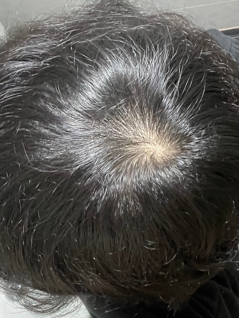 다모다트 약 8개월