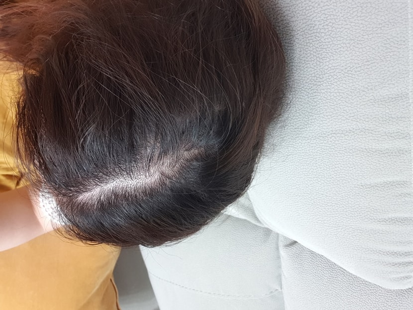 처음시작시